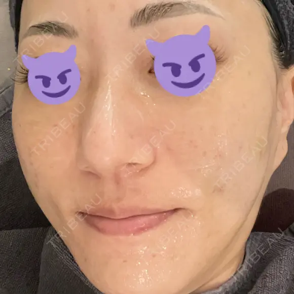 ポテンツァ 聖心美容クリニック 福岡院 AFTER メイン用