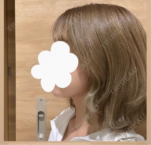 糸リフト / 脂肪吸引（顔） セギム美容整形外科 DAY 91 メイン用