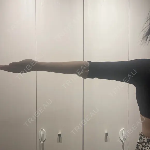 脂肪吸引（二の腕） ルラ美容クリニック 千葉院 / ルラスキンクリニック 千葉院 DAY 0 メイン用