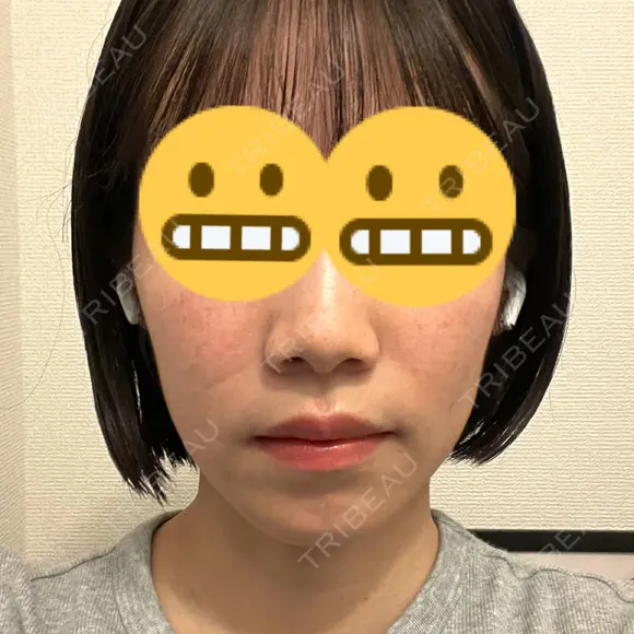 セットバック カトレア歯科・美容クリニック DAY 68 メイン用