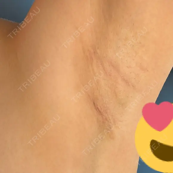 豊胸（シリコンバッグ） / 豊胸（脂肪注入） / 豊胸（シリコン＋脂肪併用） / その他（胸） お茶の水美容形成クリニック DAY 26 メイン用