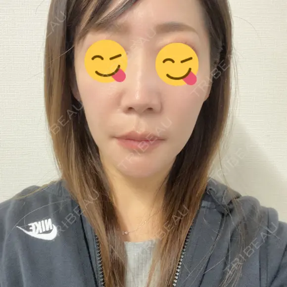 セットバック 大塚美容形成外科・歯科 大塚本院 DAY 277 メイン用