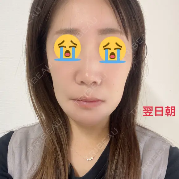 セットバック 大塚美容形成外科・歯科 大塚本院 DAY 277 メイン用