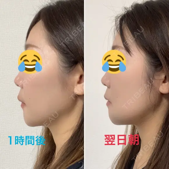 セットバック 大塚美容形成外科・歯科 大塚本院 DAY 277 メイン用
