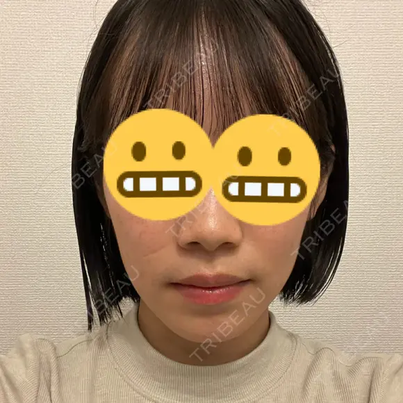 セットバック カトレア歯科・美容クリニック DAY 89 メイン用