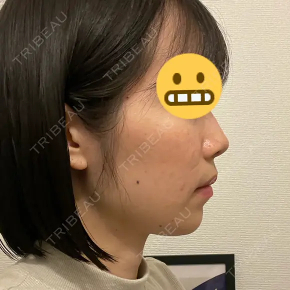 セットバック カトレア歯科・美容クリニック DAY 89 メイン用