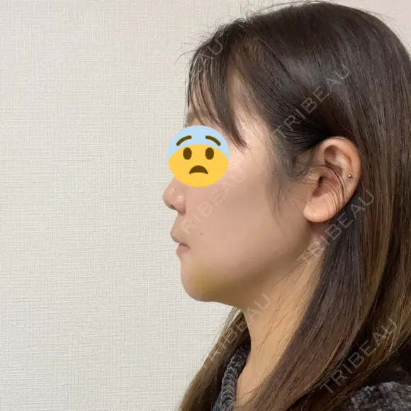 セットバック 大塚美容形成外科・歯科 大塚本院 DAY 280 メイン用