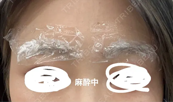 アートメイク（眉） セカジソウォン医院-明洞店 DAY 0 メイン用