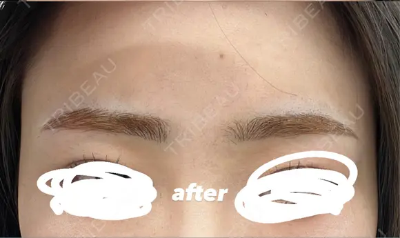 アートメイク（眉） セカジソウォン医院-明洞店 DAY 0 メイン用