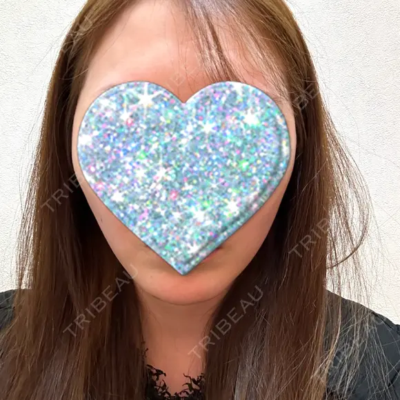 ボトックス（エラ・小顔） TCB東京中央美容外科 松戸院 AFTER メイン用