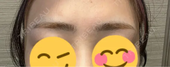 アートメイク（眉） セカジソウォン医院-明洞店 AFTER メイン用