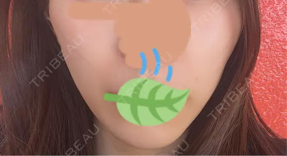 糸リフト / 肌ヒアルロン酸注入（たるみ・シワ改善） 上野美容外科・美容皮膚科 DAY 0 メイン用