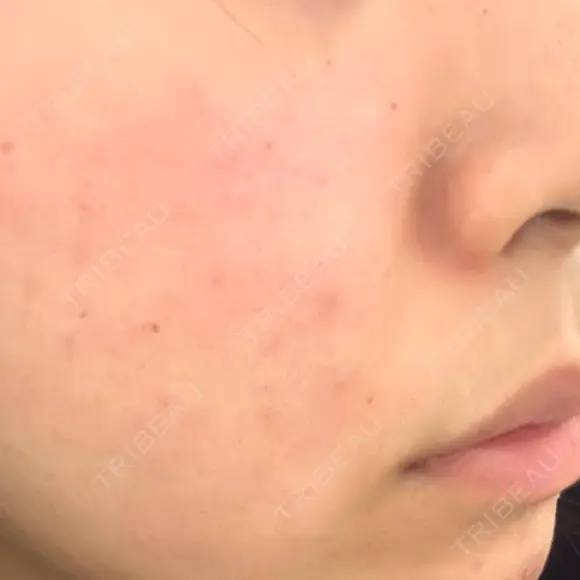 ポテンツァ 上野美容外科・美容皮膚科 AFTER メイン用