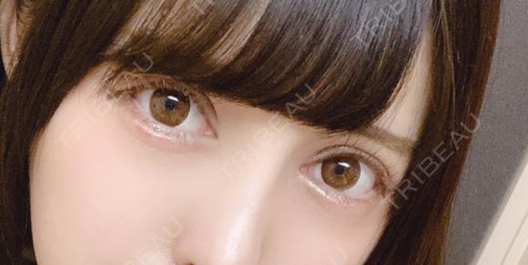 二重切開 / 眼瞼下垂（切開） / 目尻切開 / タレ目形成・グラマラスライン（切開） / ヒアルロン酸注入（涙袋） ジュエリー美容外科 DAY 12 メイン用