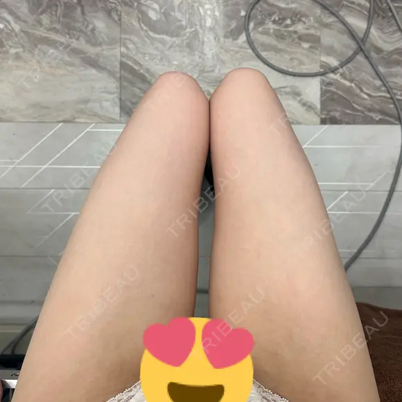 豊胸（シリコンバッグ） / 豊胸（脂肪注入） / 豊胸（シリコン＋脂肪併用） / その他（胸） お茶の水美容形成クリニック AFTER メイン用