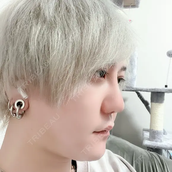 二重切開 / 目頭切開 / 眼瞼下垂（切開） / 隆鼻術 / 鼻中隔延長（切開） / 小鼻縮小（切開） / 骨切幅寄せ id（アイディ）美容外科 DAY 21 メイン用
