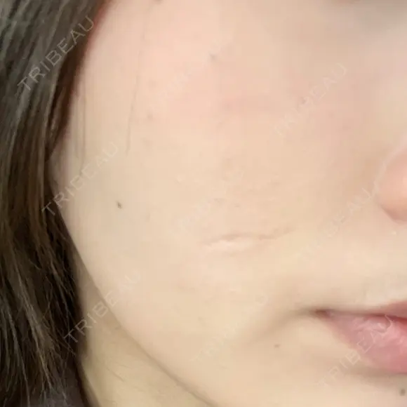 ポテンツァ 上野美容外科・美容皮膚科 AFTER メイン用