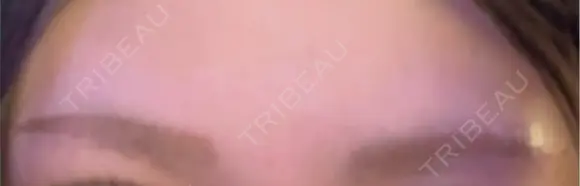 アートメイク（眉） Tokyo Tensei Clinic 新宿院 DAY 0 メイン用