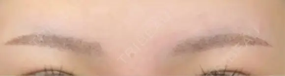 アートメイク（眉） Tokyo Tensei Clinic 新宿院 AFTER メイン用