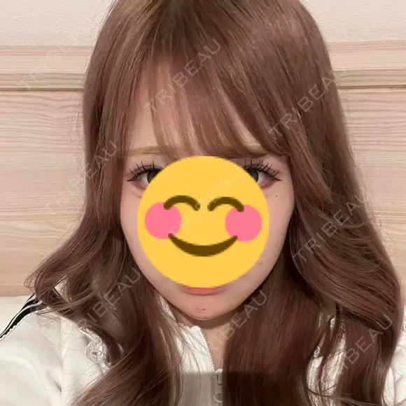 ヒアルロン酸注入（あご） BIZENNクリニック【ビゼンクリニック】 DAY 0 メイン用