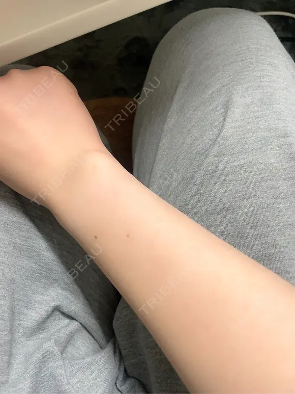 美容点滴・美容注射（美肌） Kinshicho Beauty Clinic （錦糸町ビューティークリニック） DAY 3 メイン用
