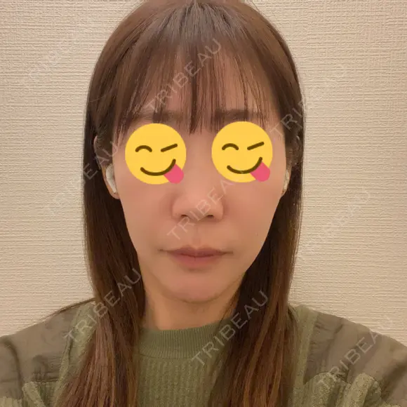 セットバック 大塚美容形成外科・歯科 大塚本院 DAY 367 メイン用