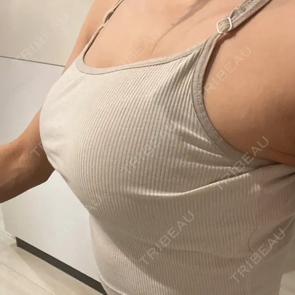 豊胸（シリコンバッグ） / ワキ汗治療（ボトックス） お茶の水美容形成クリニック AFTER メイン用