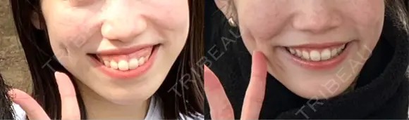 セットバック カトレア歯科・美容クリニック DAY 200 メイン用