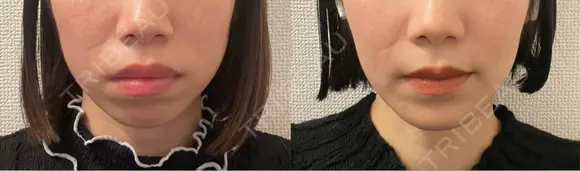 セットバック カトレア歯科・美容クリニック DAY 210 メイン用