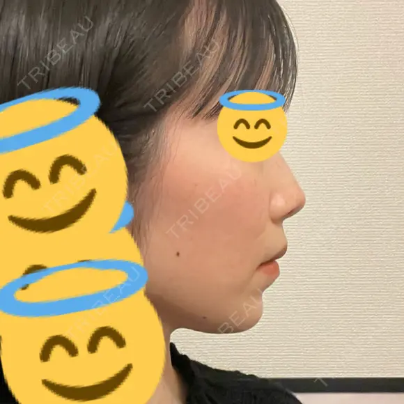 セットバック カトレア歯科・美容クリニック DAY 210 メイン用