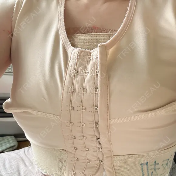 豊胸（シリコンバッグ） 共立美容外科 仙台院 DAY 0 メイン用