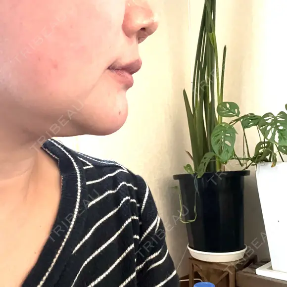 その他（輪郭） YAYOI CLINIC DAY 1 メイン用