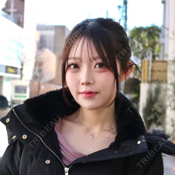 糸リフト / 脂肪吸引（顔） / インディバ（顔） / 美容点滴・美容注射（疲労回復） HAAB×DREAM BEAUTY CLINIC 東京本院 DAY 64 メイン用