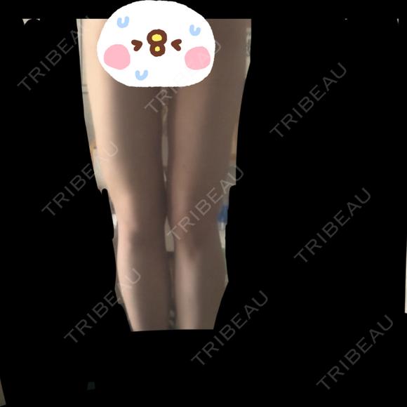 脂肪吸引（脚） オアシス美容外科 DAY 19 メイン用