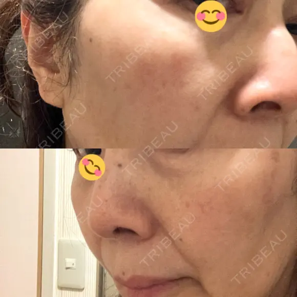 ルメッカ BAO CLINIC 神戸院 AFTER メイン用