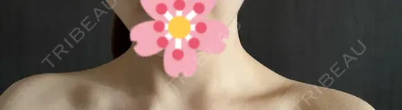 ボトックス（肩） ルラ美容クリニック 札幌本院 DAY 5 メイン用