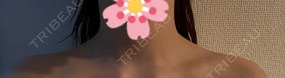 ボトックス（肩） ルラ美容クリニック 札幌本院 AFTER メイン用