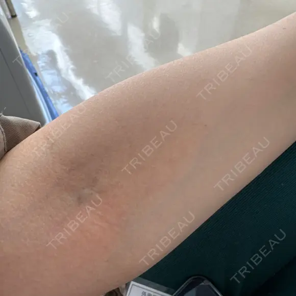 美容点滴・美容注射（疲労回復） REVO CLINIC PLUS AFTER メイン用