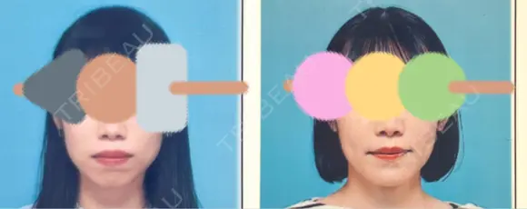 セットバック カトレア歯科・美容クリニック AFTER メイン用