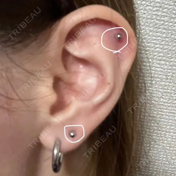 ピアス穴あけ 宇都宮竹内クリニック AFTER メイン用