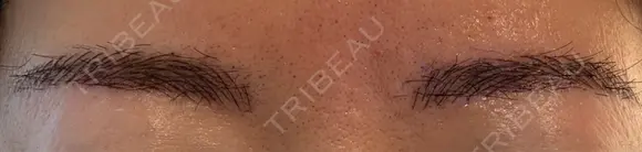 アートメイク（眉） 表参道メディカルクリニック 新宿院 DAY 50 メイン用