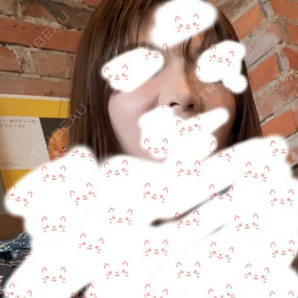 ヒアルロン酸注入（鼻） TCB東京中央美容外科 青森院 DAY 7 メイン用