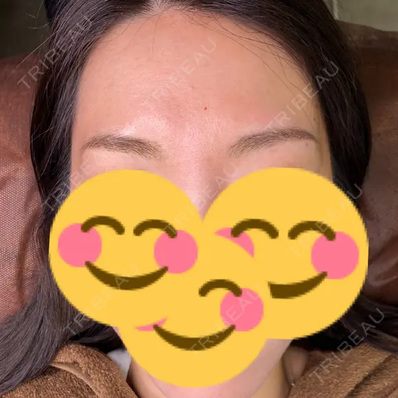 アートメイク（眉） BMC CLINIC 南青山 AFTER メイン用