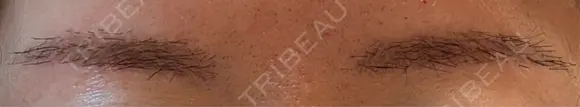 アートメイク（眉） 表参道メディカルクリニック 新宿院 AFTER メイン用