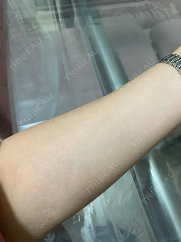 白玉点滴・注射 城本クリニック 大阪院 DAY 7 メイン用