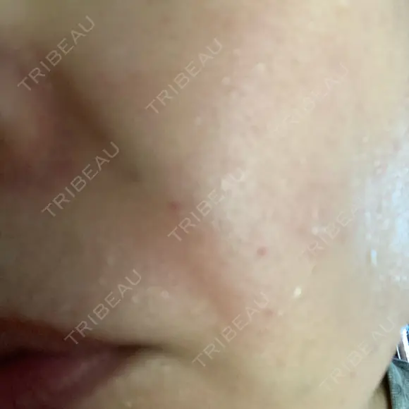 ショッピングリフト BAO CLINIC 梅田院 DAY 2 メイン用