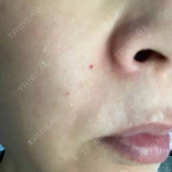 ショッピングリフト BAO CLINIC 梅田院 DAY 2 メイン用