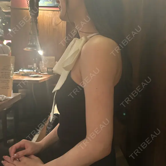 脂肪吸引（二の腕） アムルーズ美容外科クリニック 横浜院 AFTER メイン用
