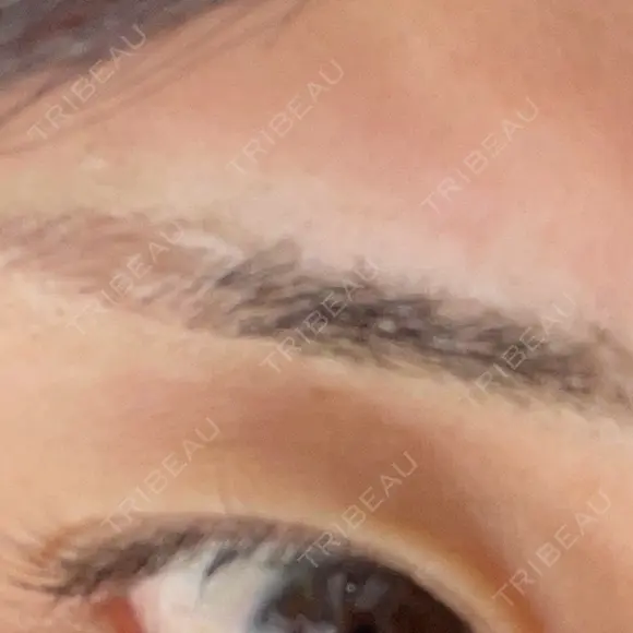 アートメイク（眉） 表参道メディカルクリニック 新宿院 DAY 0 メイン用