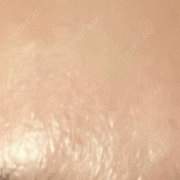 高濃度ビタミンC点滴 新宿美容外科ネビュラクリニック DAY 2 メイン用